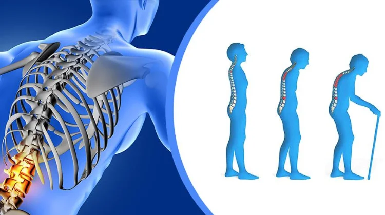 best Osteoporosis hospitals in Hyderabad, top 10 orthopedic surgeons in Hyderabad.